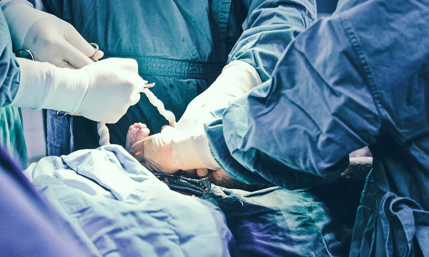 baby being born via caesarean section