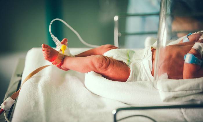 Preterm baby