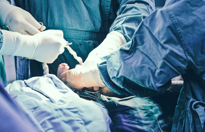 baby being born via caesarean section